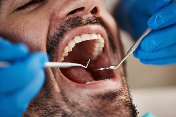 Best Emergency Tooth Extraction in Prices Fork, VA