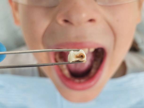 Best Emergency Denture Repair in Prices Fork, VA